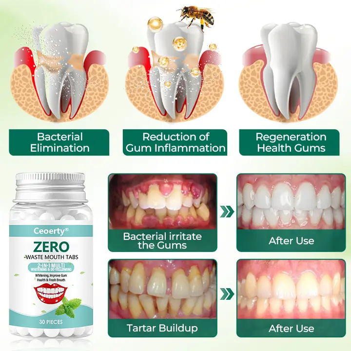 Ceoerty® Zero-Waste Mouth Tabs