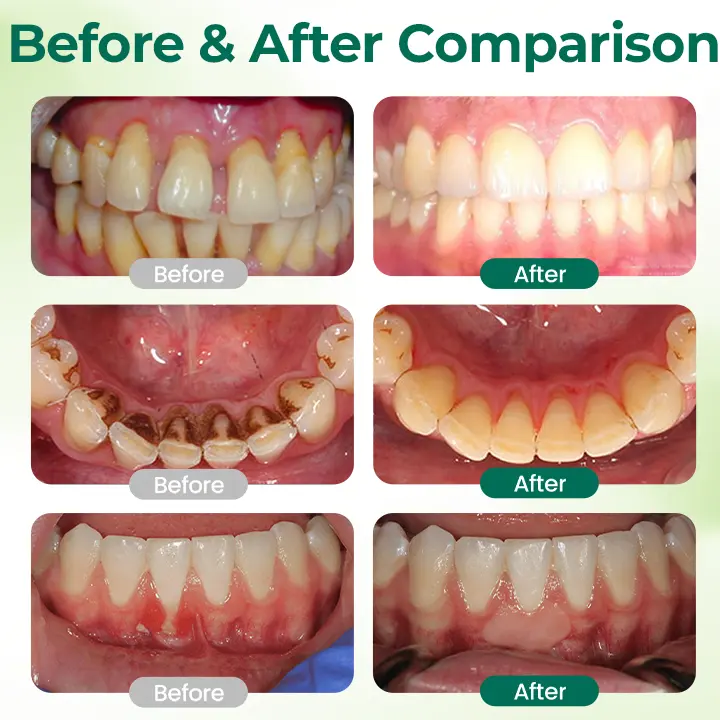 Ceoerty® Zero-Waste Mouth Tabs