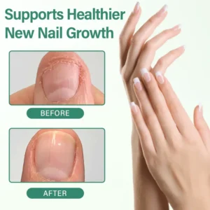 Ceoerty® Nail Detox Penetration Serum Pen