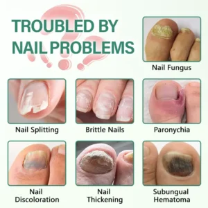 Ceoerty® Nail Detox Penetration Serum Pen