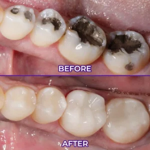 Ceoerty® VioletX Advanced Whitening Complex